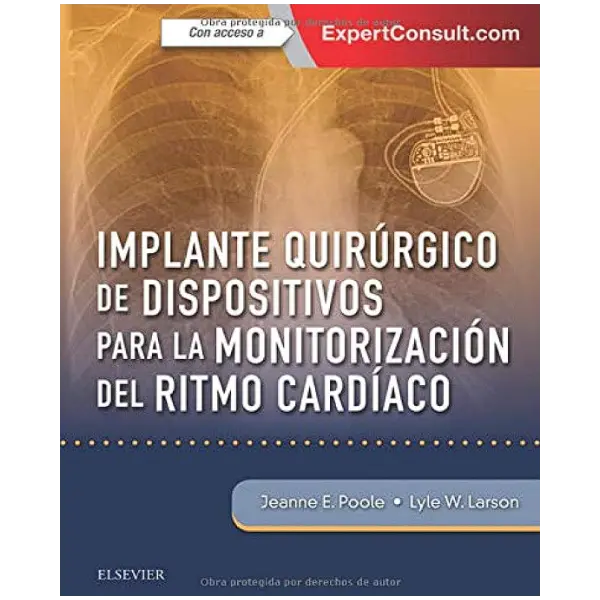 Libro Implante quirúrgico de dispositivos para la monitorización del ritmo cardíaco