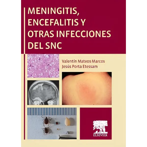 Libro Meningitis, encefalitis y otras infecciones del snc