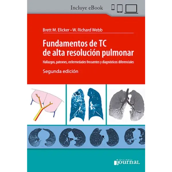 Libro Fundamentos de TC de alta resolución pulmonar 2.ª Edición.