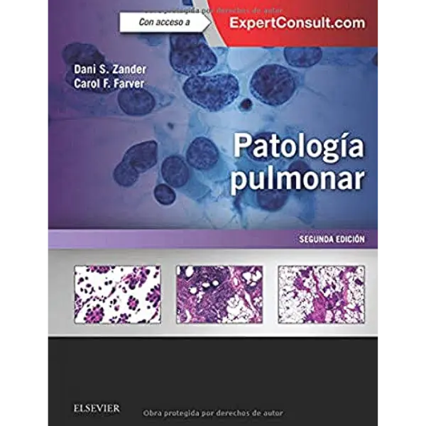 Libro Patología pulmonar 2.ª Edición