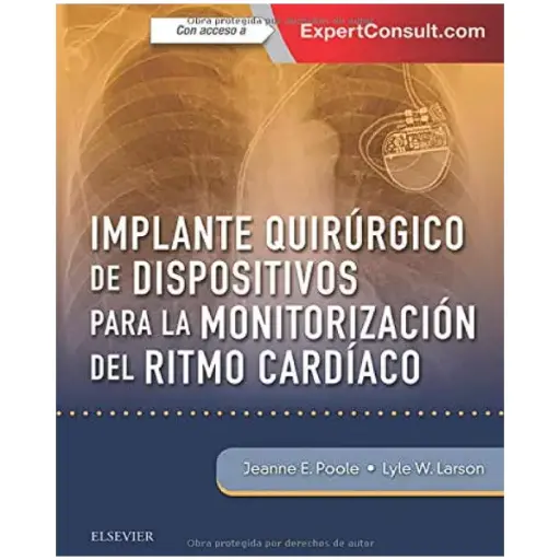 Libro Implante quirúrgico de dispositivos para la monitorización del ritmo cardíaco