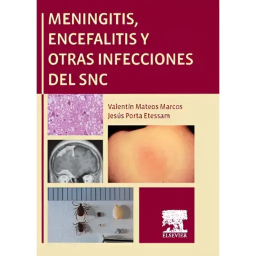 Libro Meningitis, encefalitis y otras infecciones del snc