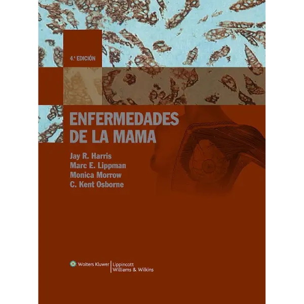 Libro Enfermedades de la mama 4.ª Edición.