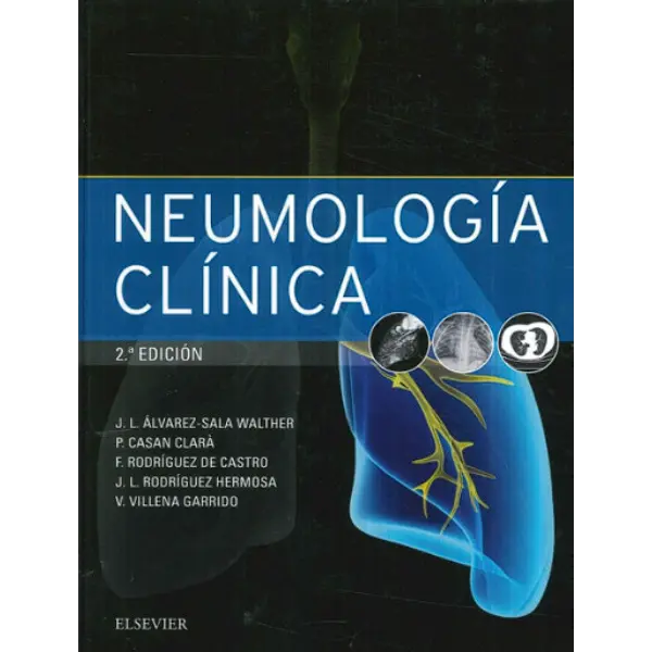 Libro Neumología clínica 2.ª Edición