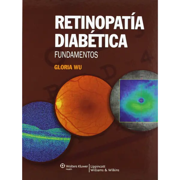 Libro Retinopatía diabética. Fundamentos