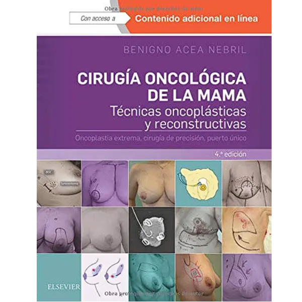 Libro Cirugía oncológica de la mama 4.ª Edición