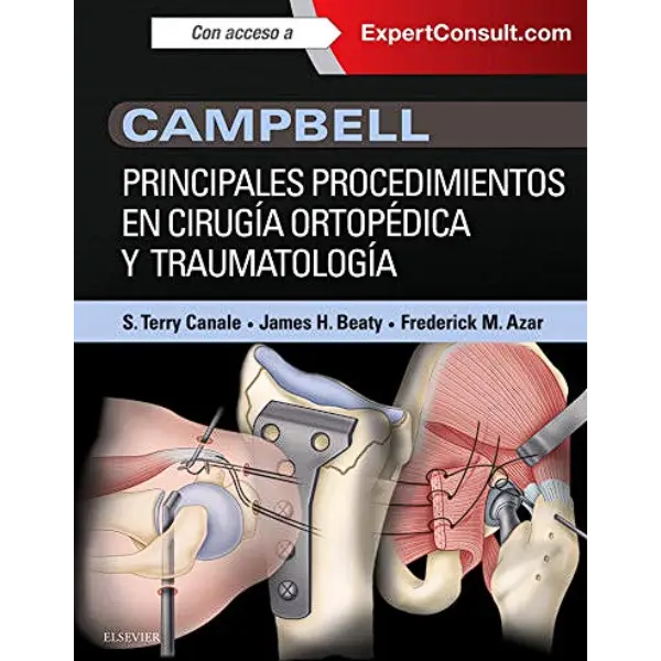 Libro Campbell. Principales procedimientos en cirugía ortopédica y traumatología