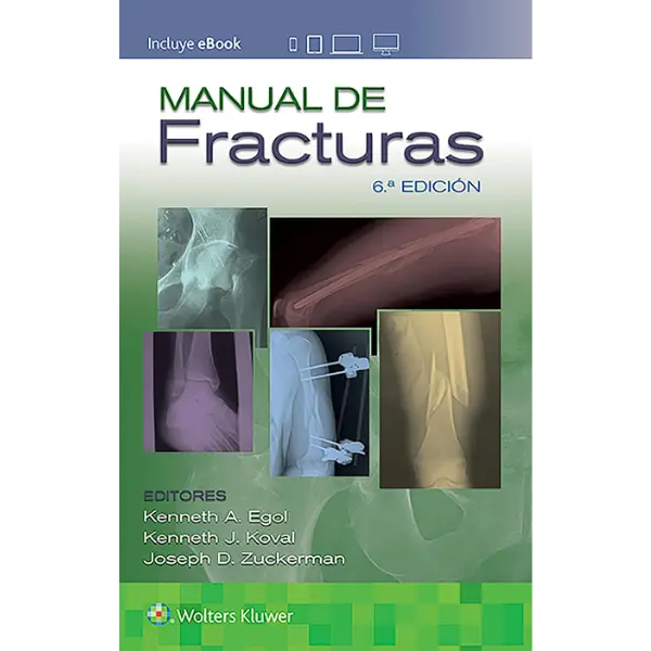 Libro Manual de Fracturas 6.ª Edición