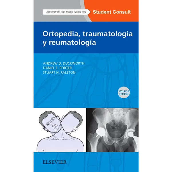Libro Ortopedia traumatología y reumatología 2.ª Edición