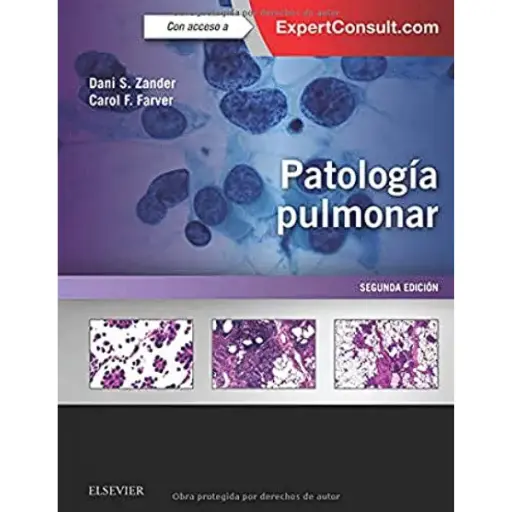 Libro Patología pulmonar 2.ª Edición